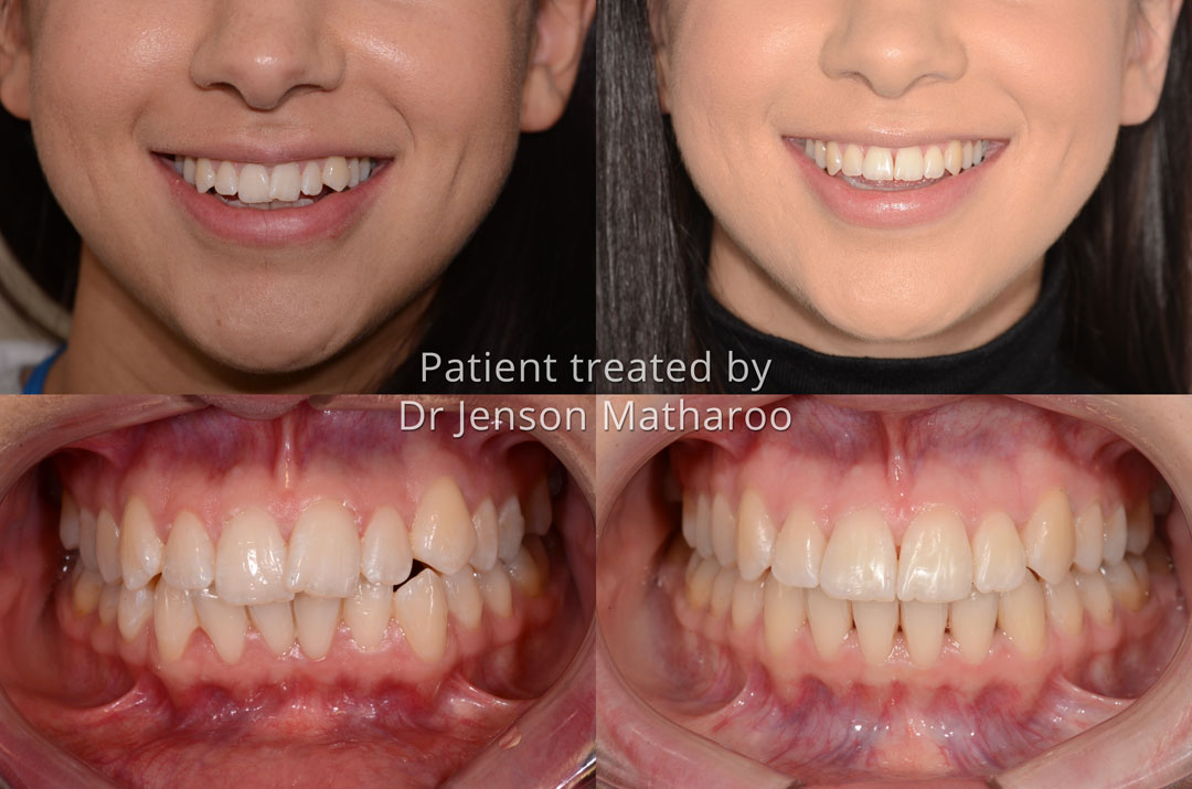 HD testimonial for Dumfries Orthodontics