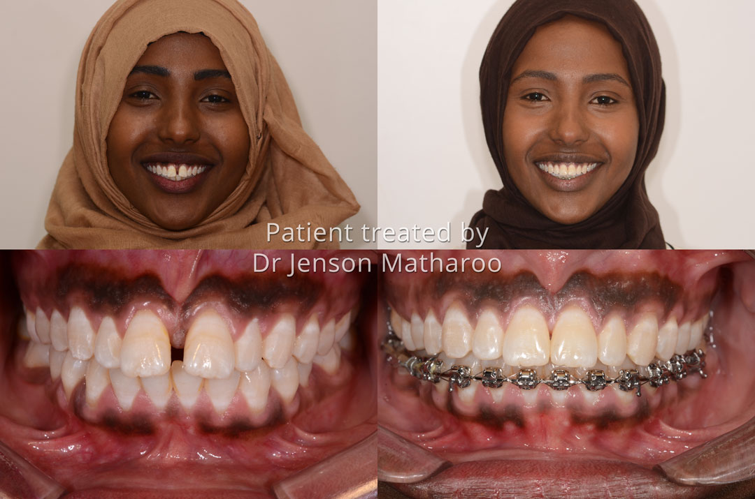 Luul testimonial for Dumfries Orthodontics