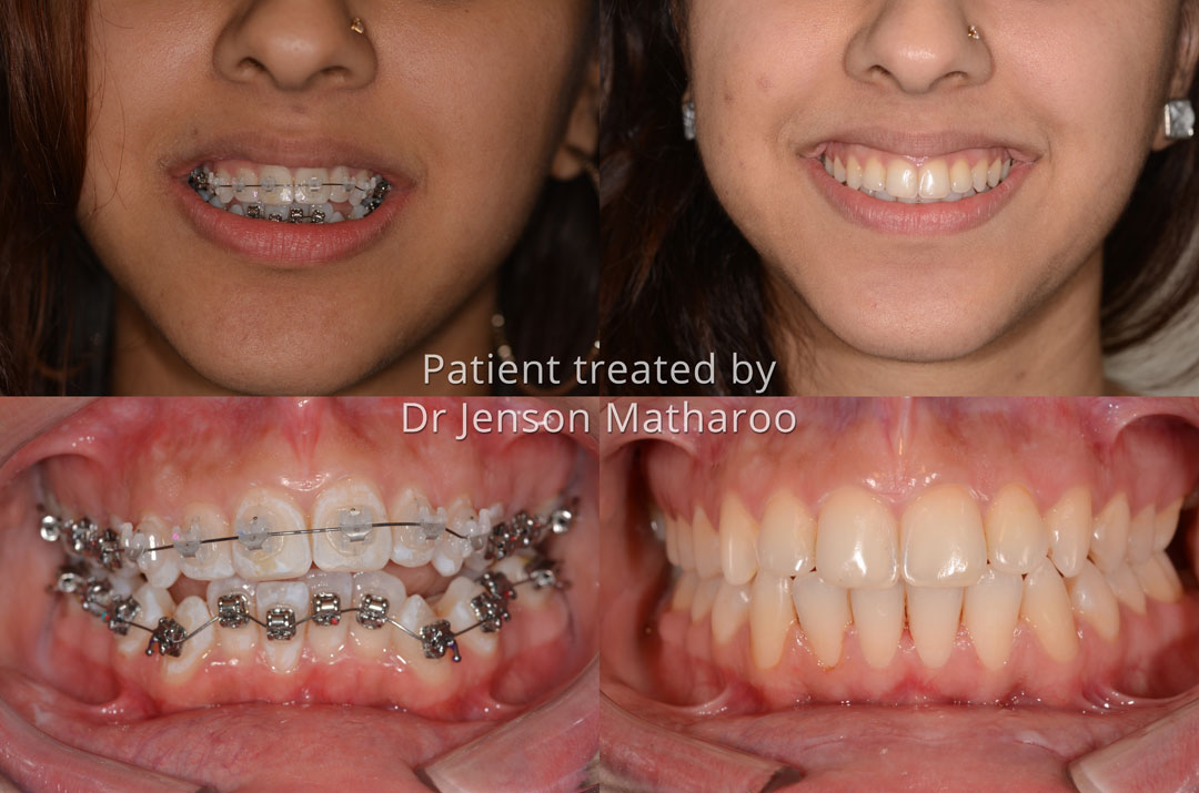 R testimonial for Dumfries Orthodontics