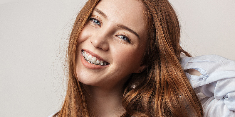 Six Month Smiles at Dumfries Orthodontics
